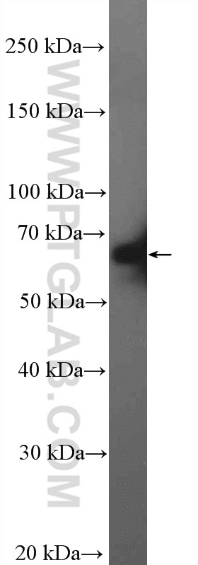 Western Blot (WB) analysis of HeLa cells using CstF-64 Polyclonal antibody (26825-1-AP)