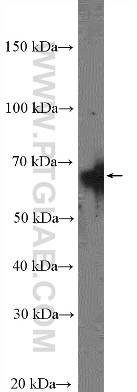 Western Blot (WB) analysis of mouse brain tissue using CstF-64 Polyclonal antibody (26825-1-AP)