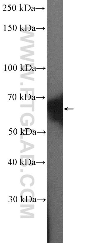 Western Blot (WB) analysis of mouse testis tissue using CstF-64 Polyclonal antibody (26825-1-AP)