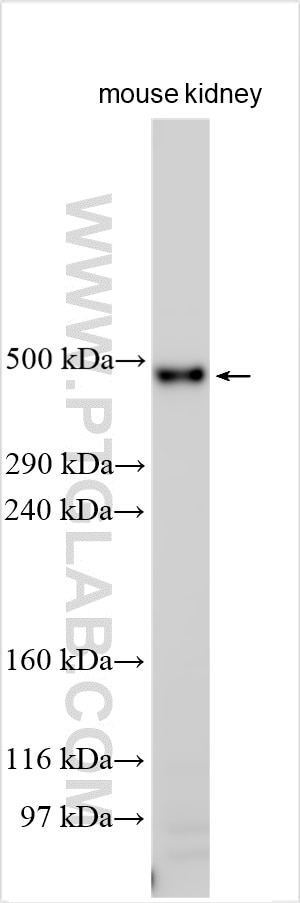 Western Blot (WB) analysis of various lysates using Cubilin Polyclonal antibody (31992-1-AP)
