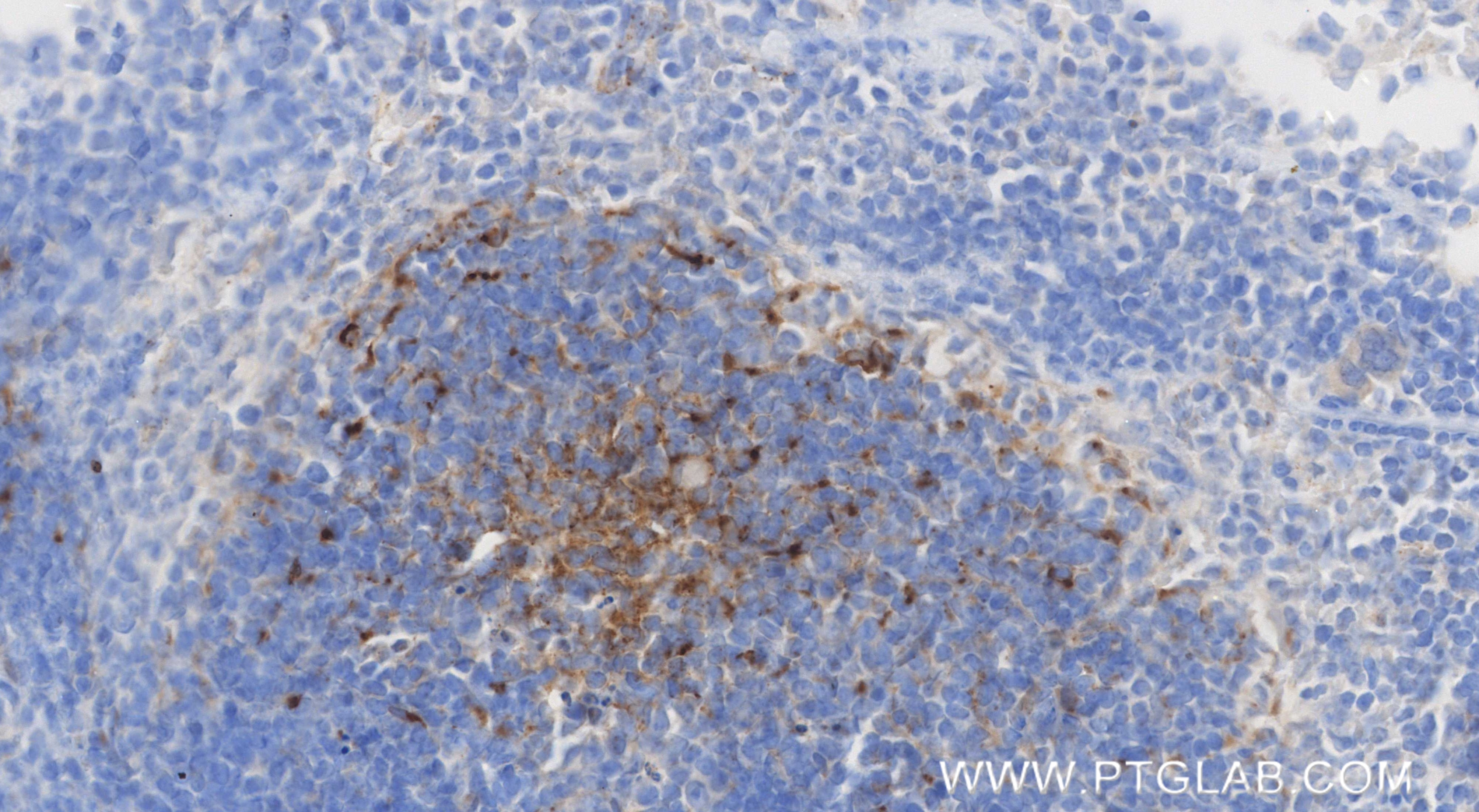 Immunohistochemistry (IHC) staining of mouse spleen tissue using CXCL13/BCA1 Recombinant monoclonal antibody (86564-1-RR)