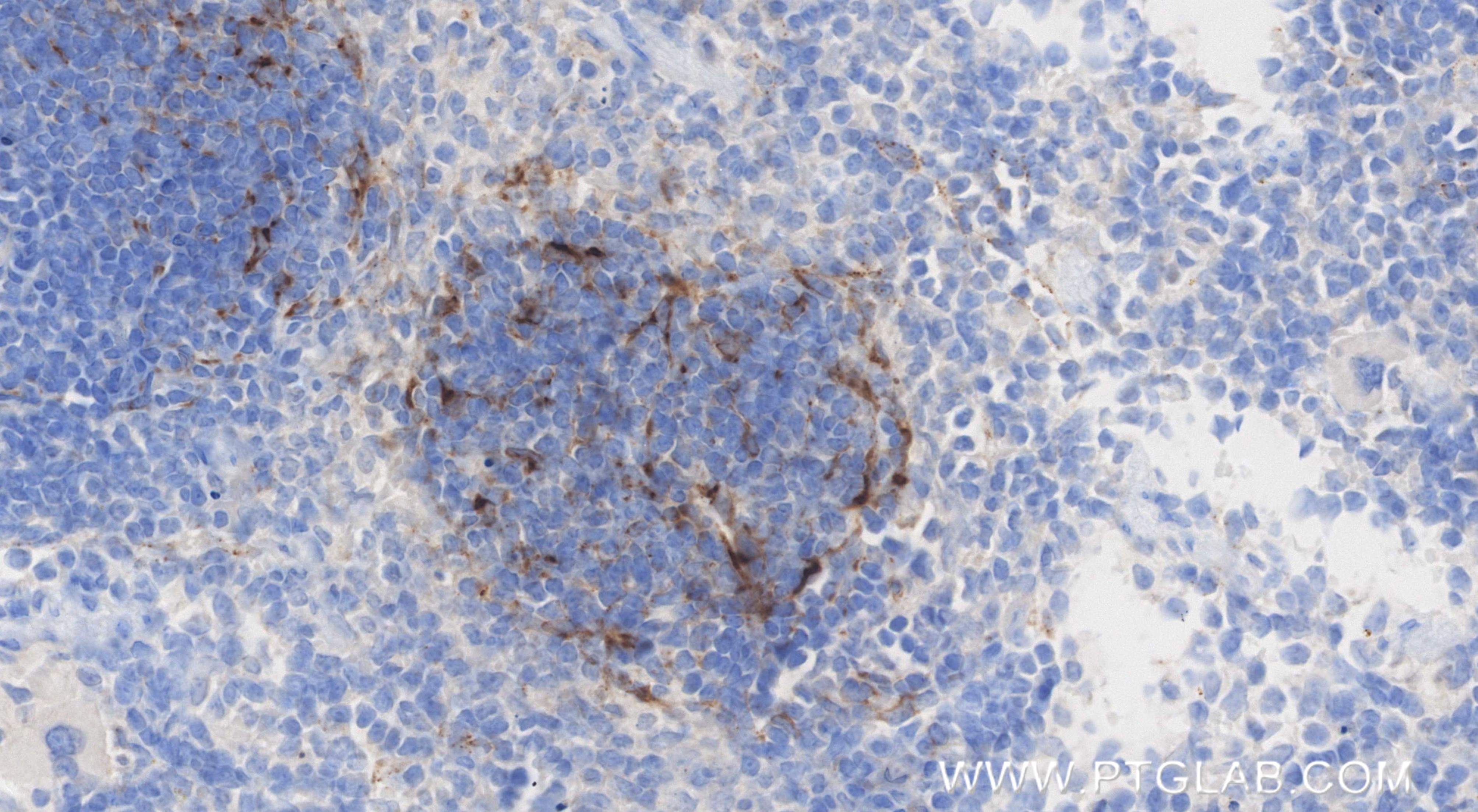 Immunohistochemistry (IHC) staining of mouse spleen tissue using CXCL13/BCA1 Recombinant monoclonal antibody (86564-1-RR)
