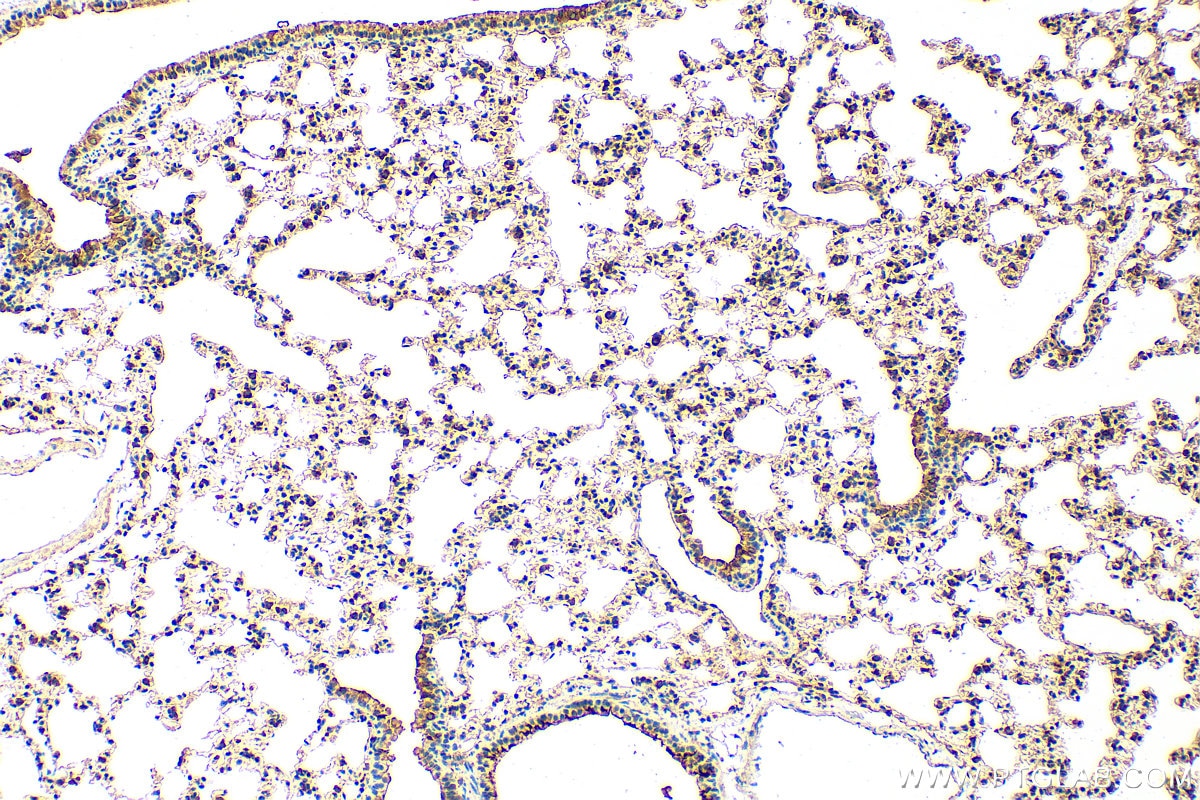 Immunohistochemistry (IHC) staining of mouse lung tissue using Cxcl15 Polyclonal antibody (31087-1-AP)