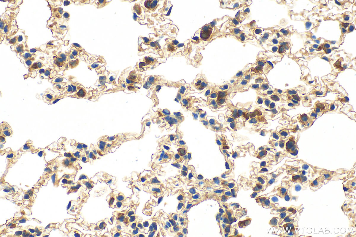 Immunohistochemistry (IHC) staining of mouse lung tissue using Cxcl15 Polyclonal antibody (31087-1-AP)