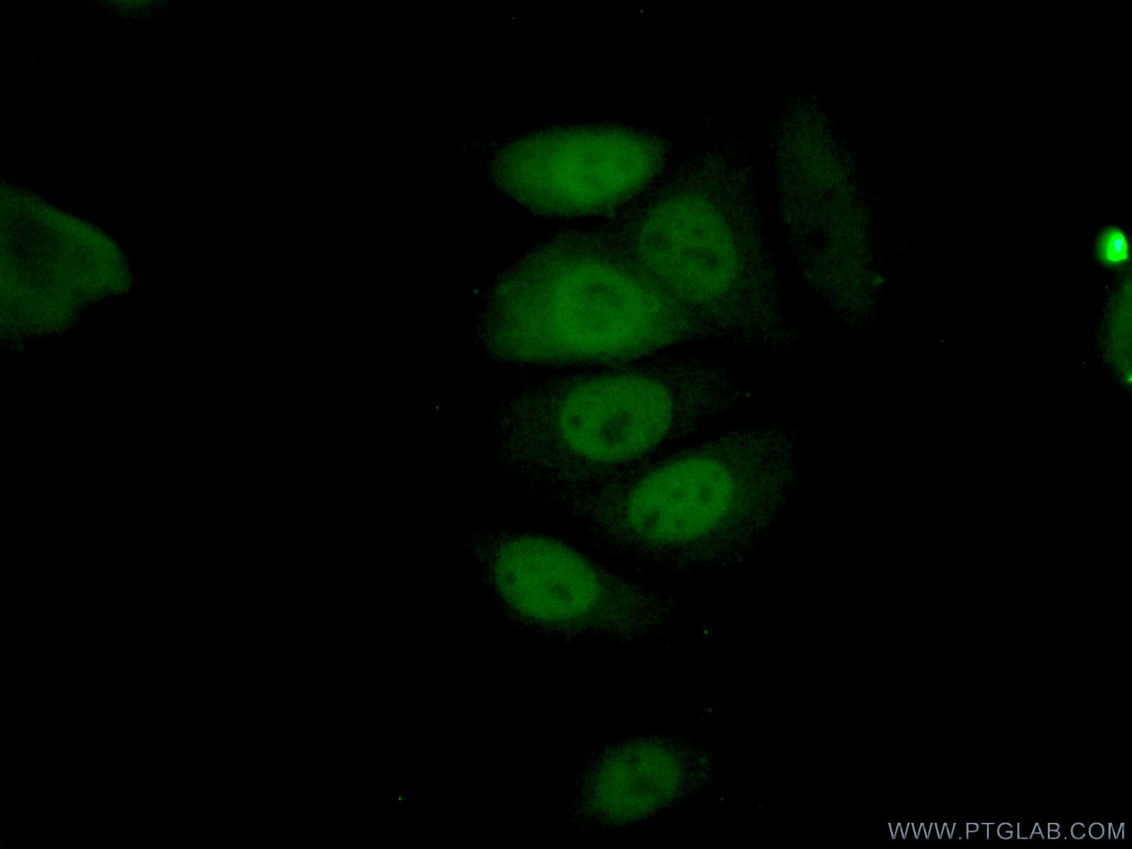 Immunofluorescence (IF) / fluorescent staining of MCF-7 cells using Cyclin A2 Monoclonal antibody (66391-1-Ig)