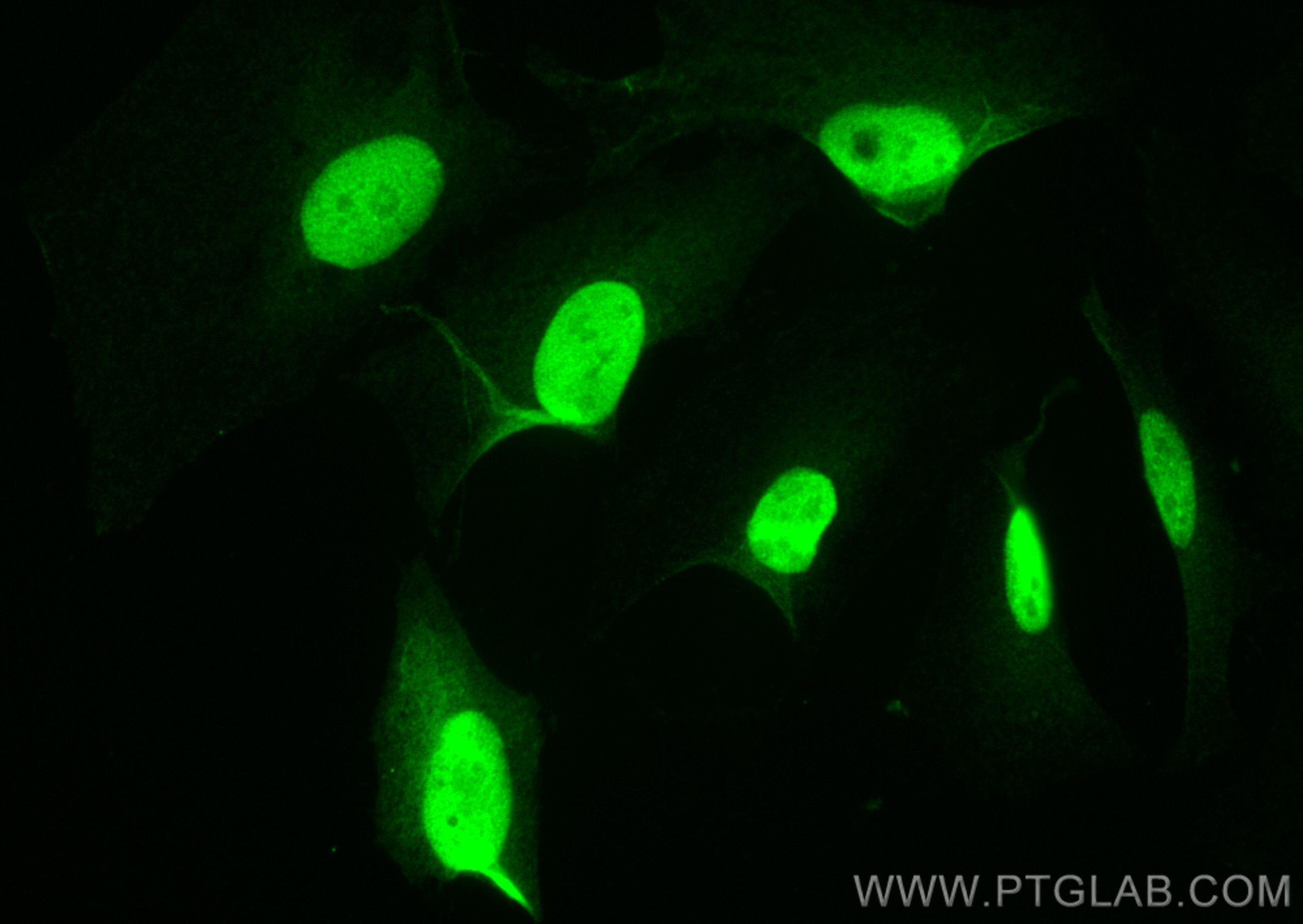 Immunofluorescence (IF) / fluorescent staining of HeLa cells using Cyclin A2 Recombinant antibody (82148-1-RR)