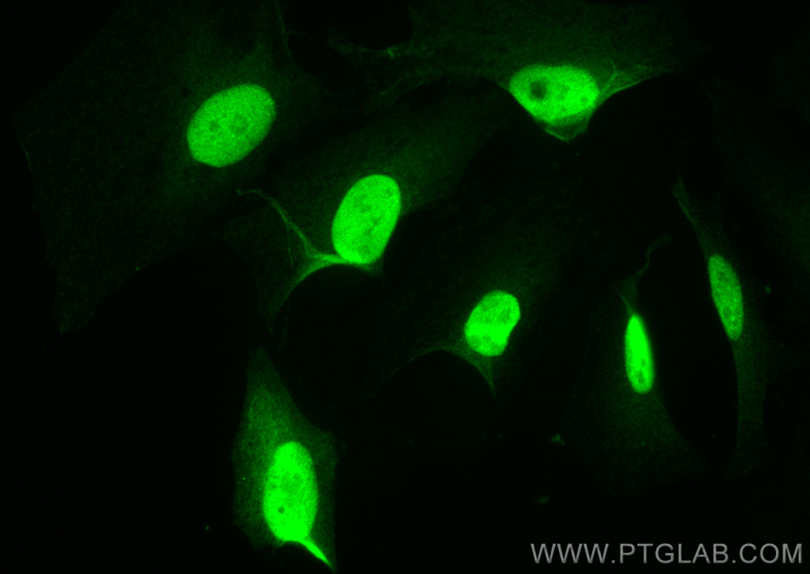 IF Staining of HeLa using 82148-1-RR