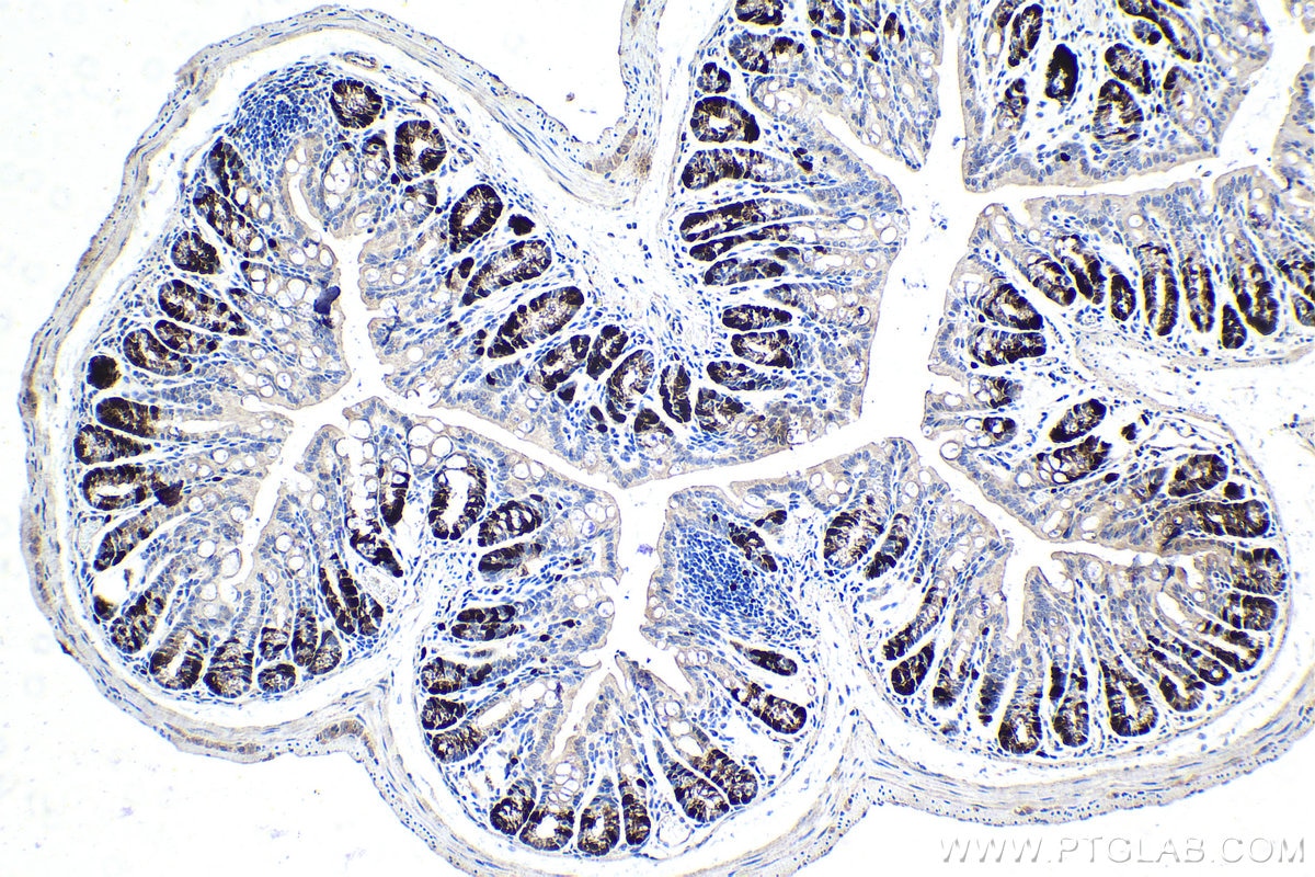 Immunohistochemistry (IHC) staining of mouse colon tissue using Cyclin A2 Recombinant antibody (82148-1-RR)