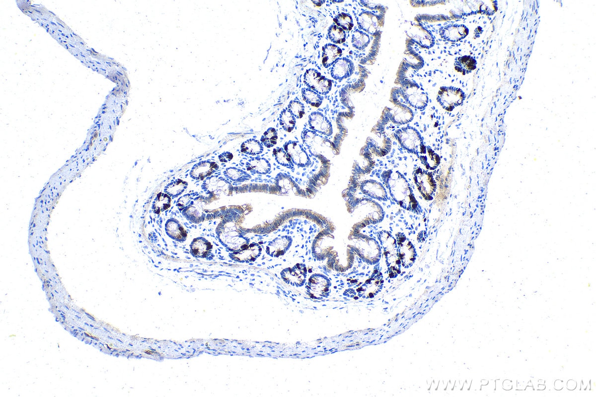 Immunohistochemistry (IHC) staining of rat colon tissue using Cyclin A2 Recombinant antibody (82148-1-RR)