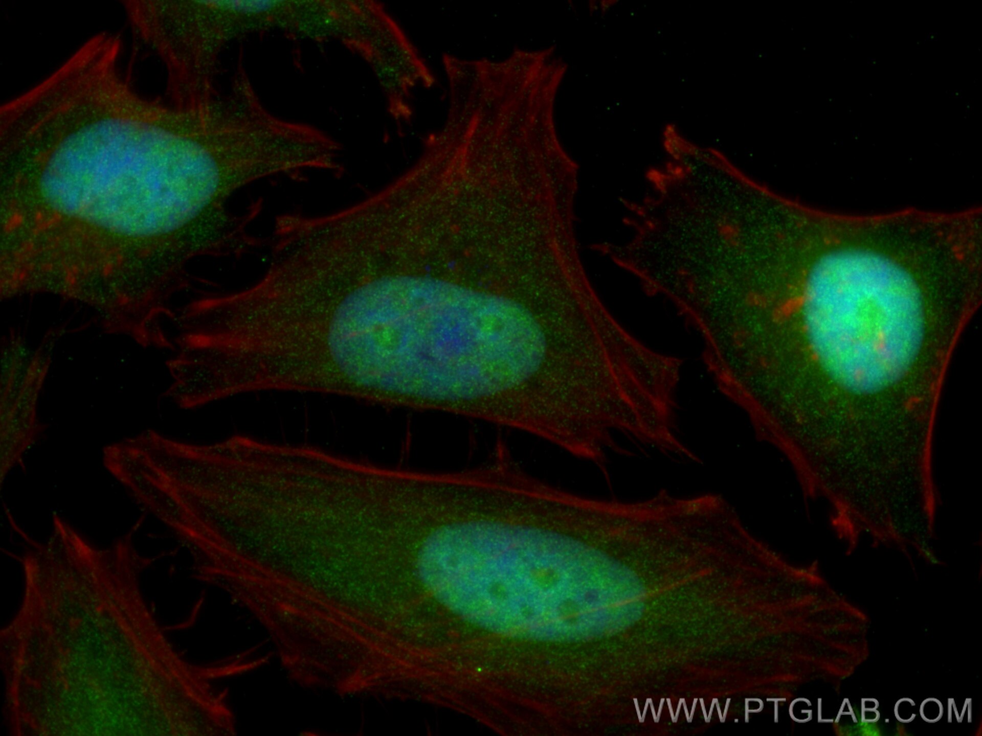 Immunofluorescence (IF) / fluorescent staining of HeLa cells using Cyclin B1 Polyclonal antibody (28603-1-AP)