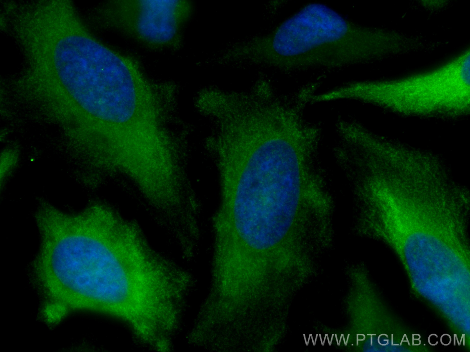 Immunofluorescence (IF) / fluorescent staining of HeLa cells using Cyclin B1 Polyclonal antibody (28603-1-AP)