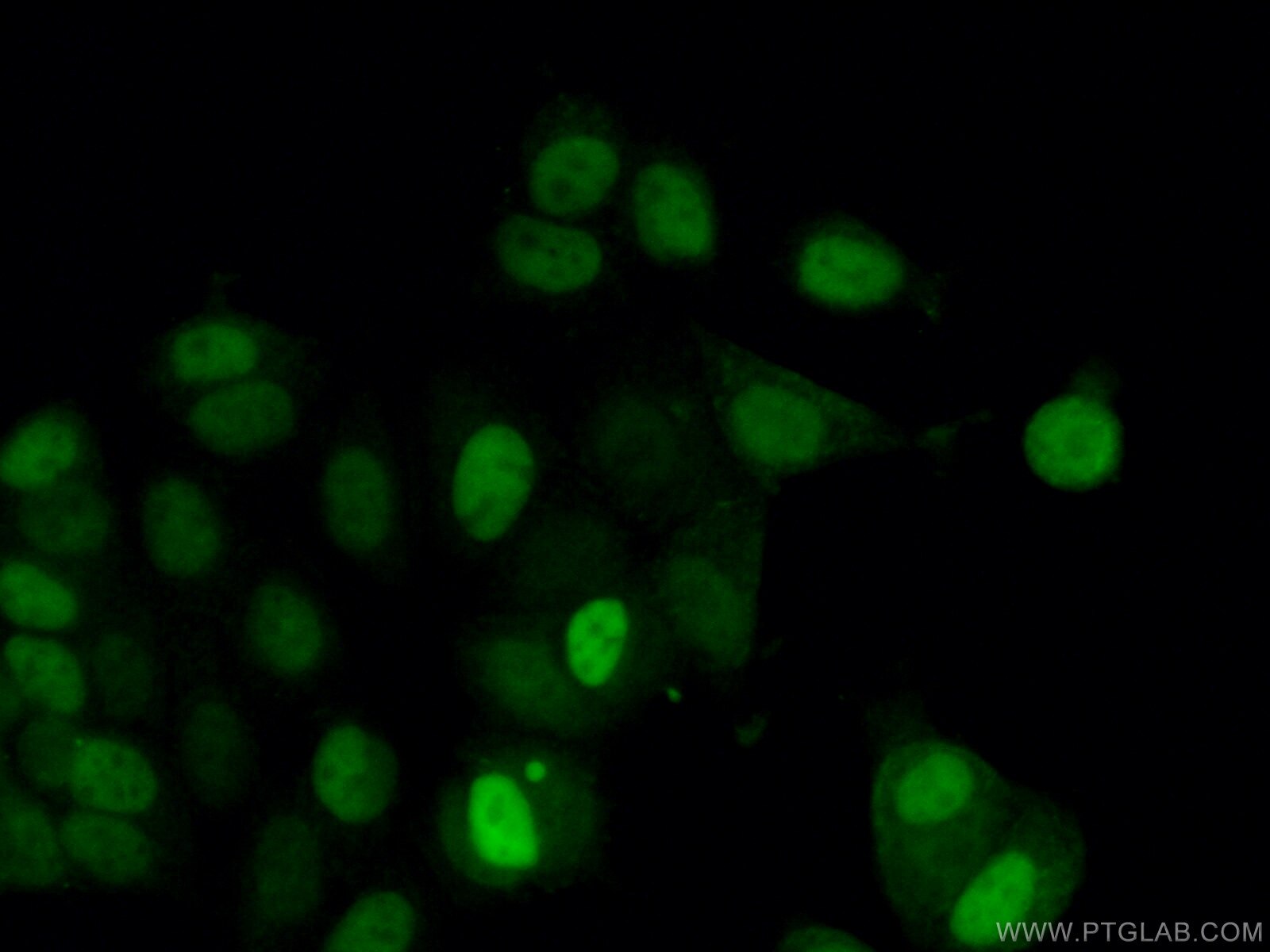 Immunofluorescence (IF) / fluorescent staining of MCF-7 cells using Cyclin D1 Polyclonal antibody (26939-1-AP)