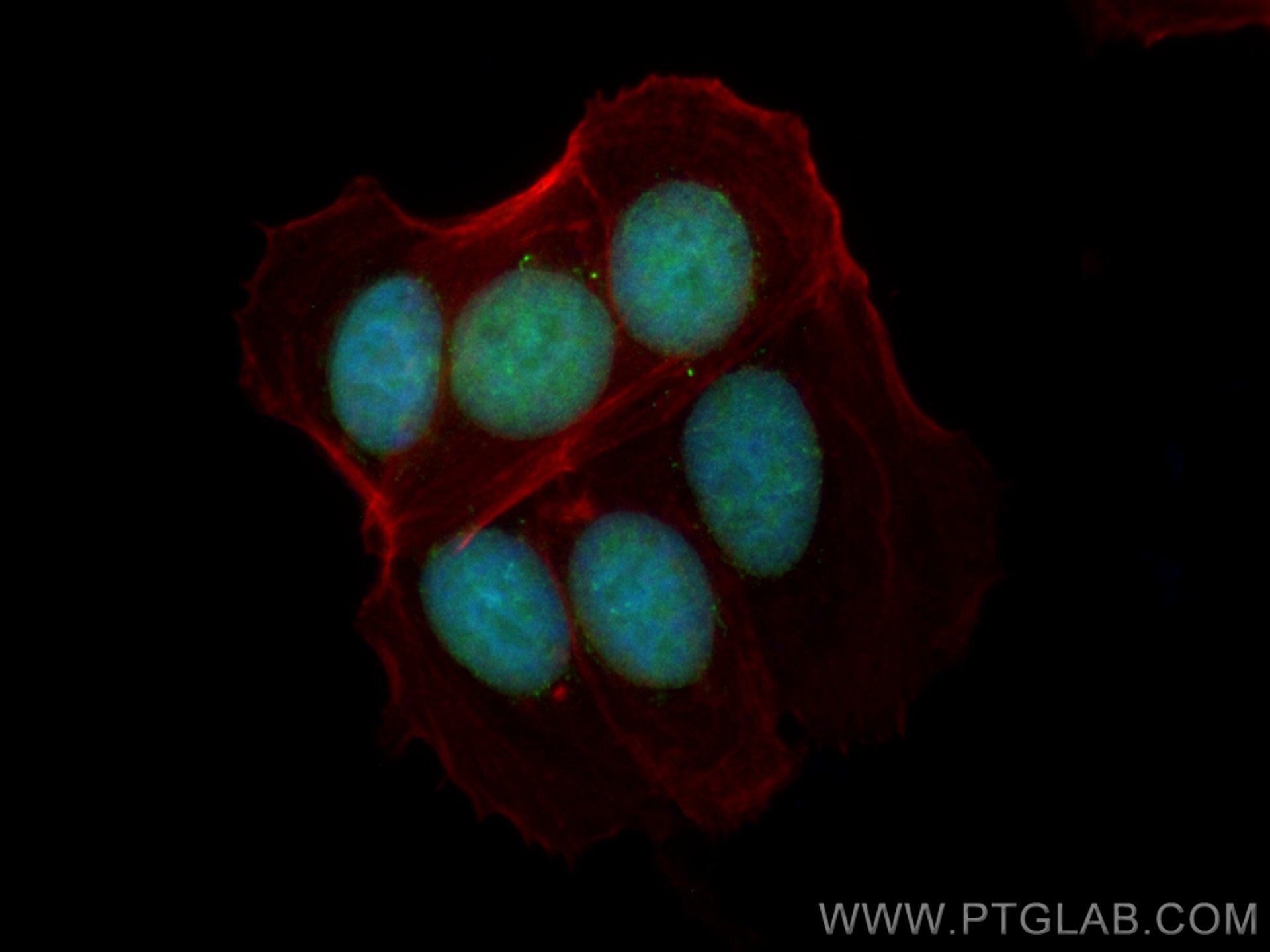 Immunofluorescence (IF) / fluorescent staining of MCF-7 cells using Cyclin D1 Polyclonal antibody (26939-1-AP)