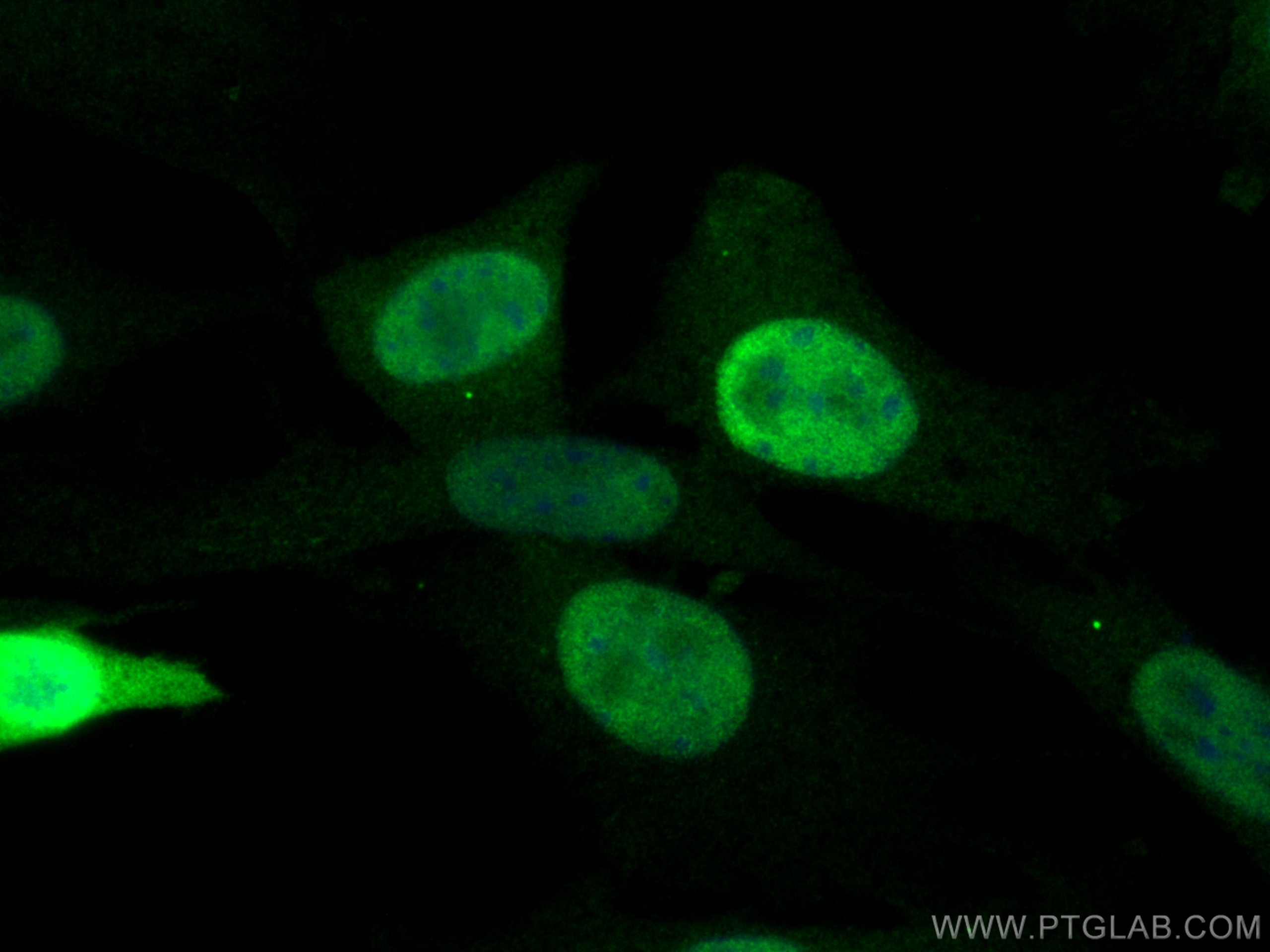 Immunofluorescence (IF) / fluorescent staining of NIH/3T3 cells using Cyclin D1 Polyclonal antibody (26939-1-AP)