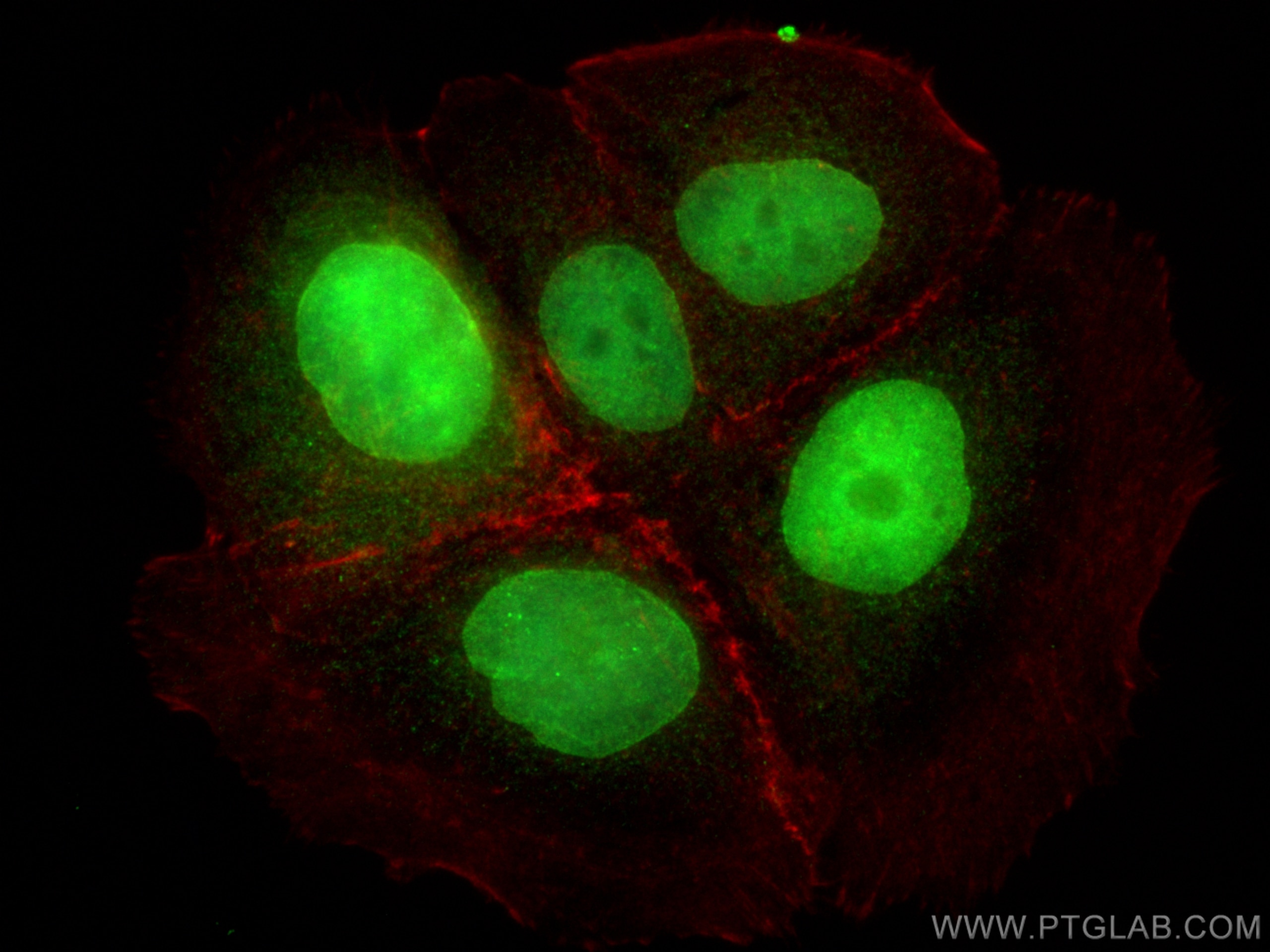 Immunofluorescence (IF) / fluorescent staining of MCF-7 cells using Cyclin D1 Polyclonal antibody (26939-1-AP)