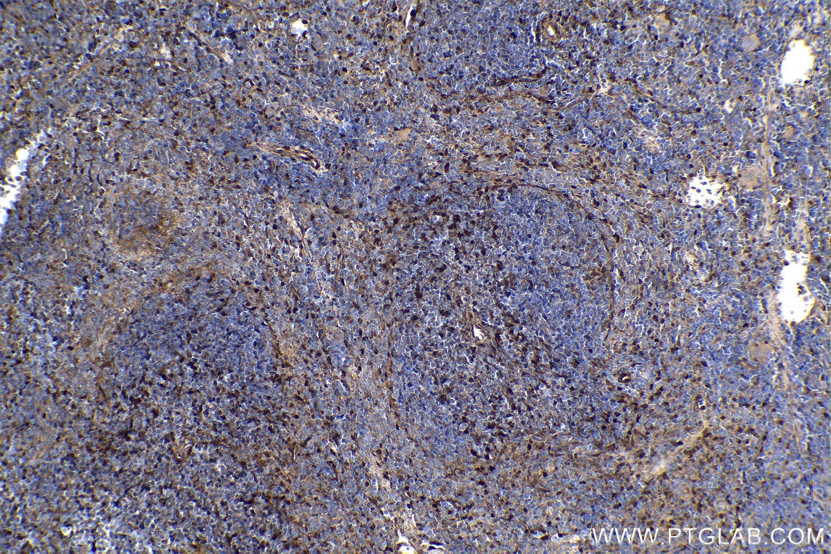 Immunohistochemistry (IHC) staining of mouse spleen tissue using Cyclin D1 Polyclonal antibody (26939-1-AP)