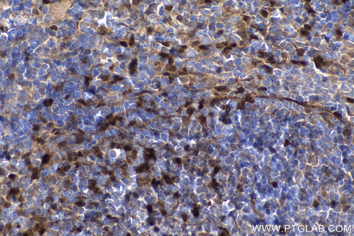 Immunohistochemistry (IHC) staining of mouse spleen tissue using Cyclin D1 Polyclonal antibody (26939-1-AP)