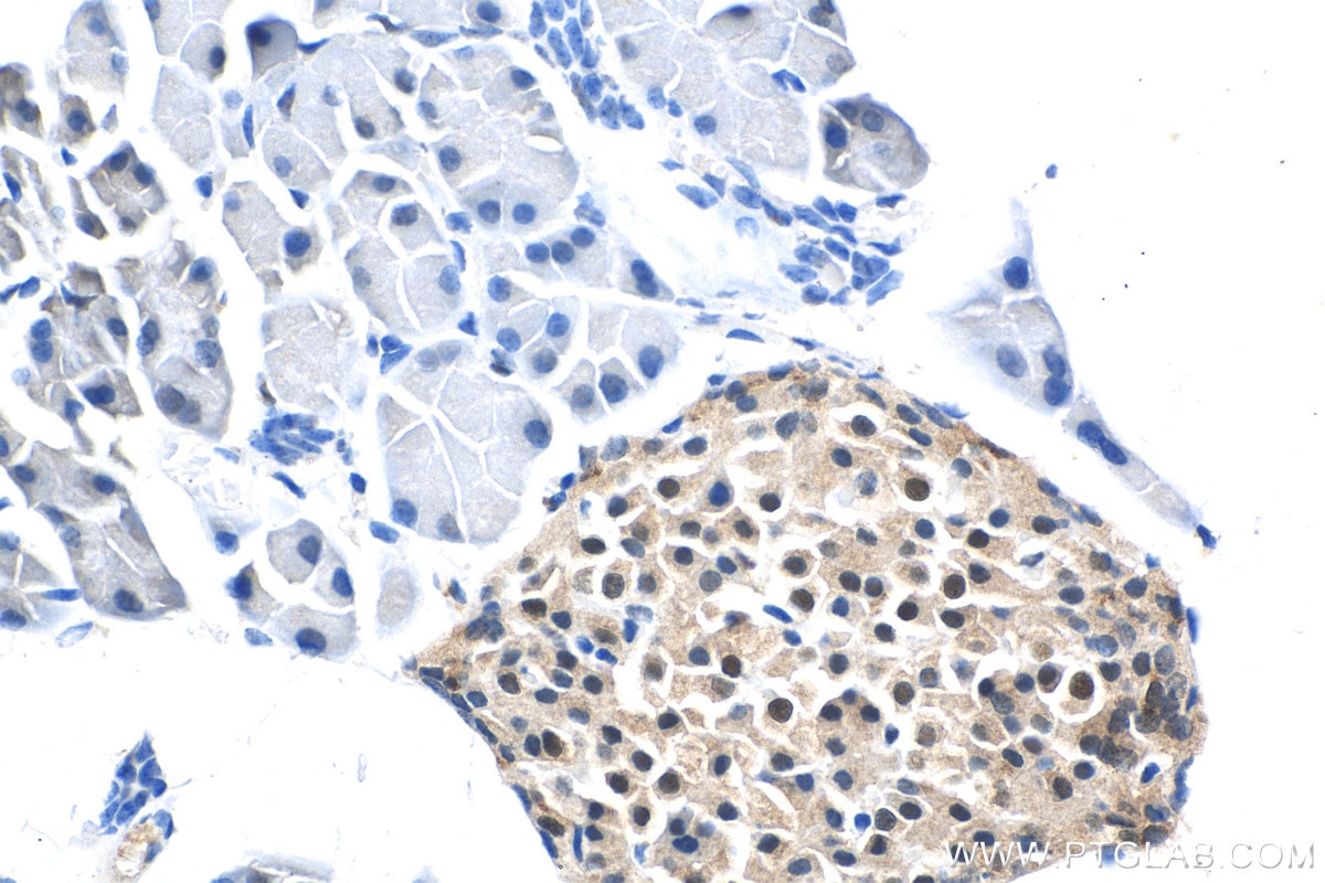 Immunohistochemistry (IHC) staining of mouse pancreas tissue using Cyclin D1 Polyclonal antibody (26939-1-AP)