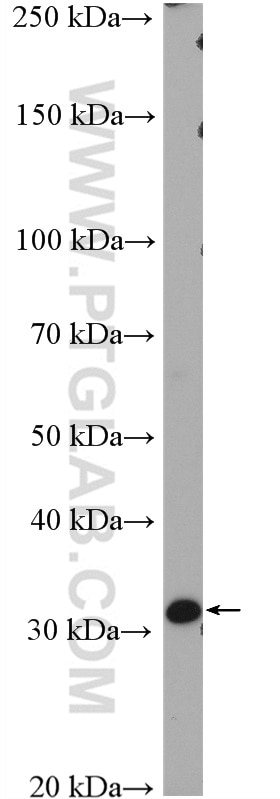 Western Blot (WB) analysis of LNCaP cells using Cyclin D1 Polyclonal antibody (26939-1-AP)