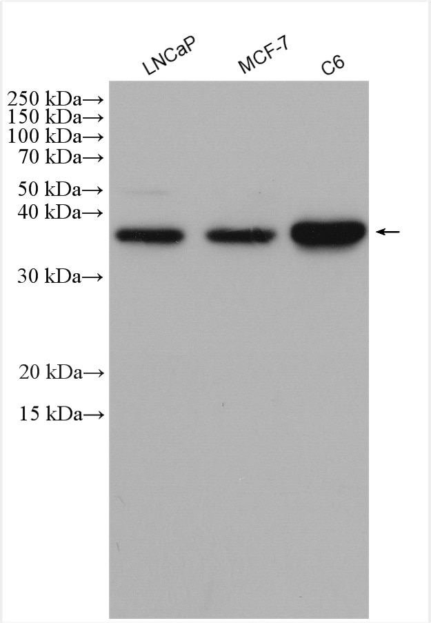 Western Blot (WB) analysis of various lysates using Cyclin D1 Polyclonal antibody (26939-1-AP)