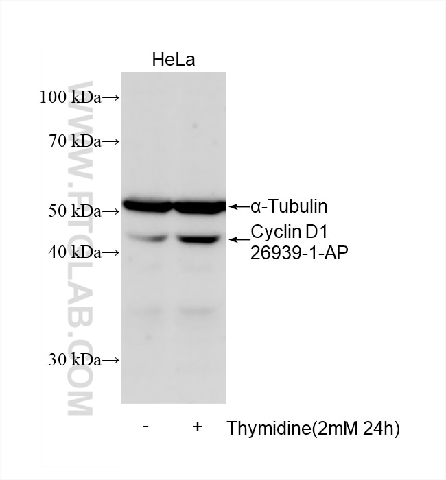 Western Blot (WB) analysis of HeLa cells using Cyclin D1 Polyclonal antibody (26939-1-AP)