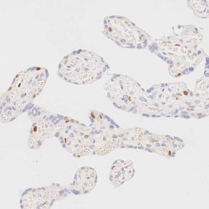 IHC staining of human placenta using 82681-1-RR Immunohistochemistry (IHC) staining of human placenta tissue using Cyclin D1 Recombinant monoclonal antibody (82681-1-RR)
