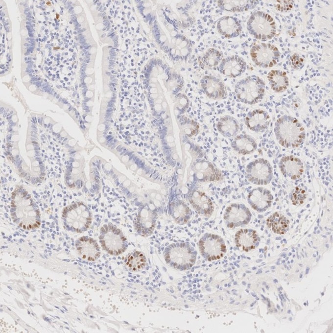 IHC staining of human small intestine using 82681-1-RR Immunohistochemistry (IHC) staining of human small intestine tissue using Cyclin D1 Recombinant monoclonal antibody (82681-1-RR)