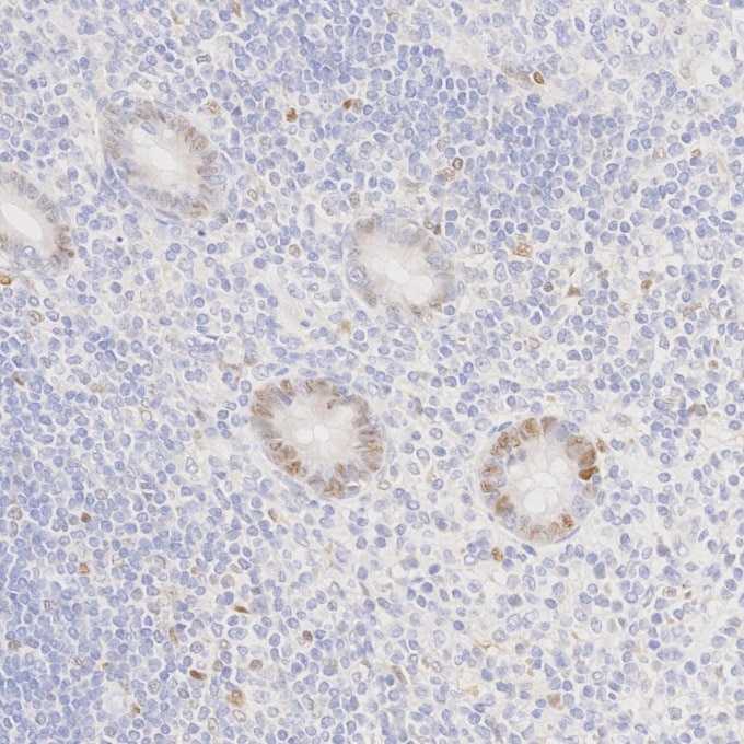 IHC staining of human appendicitis using 82681-1-RR Immunohistochemistry (IHC) staining of human appendicitis tissue using Cyclin D1 Recombinant monoclonal antibody (82681-1-RR)