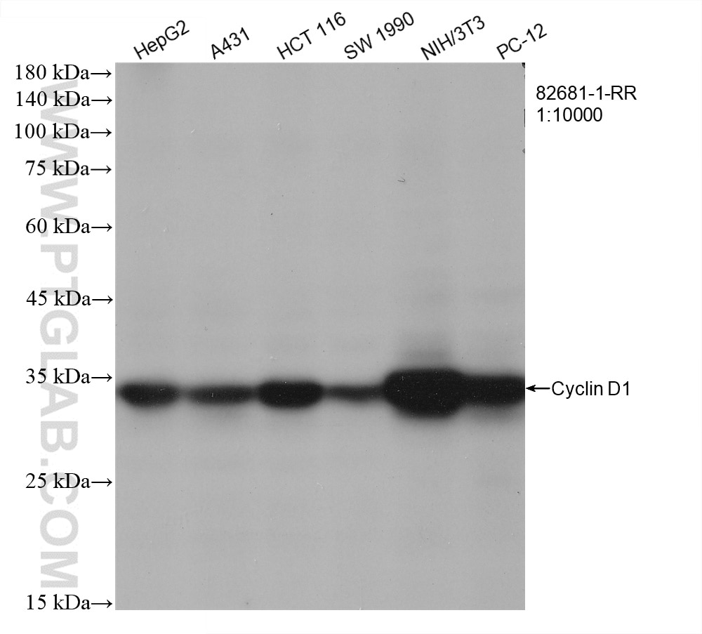 Western Blot (WB) analysis of various lysates using Cyclin D1 Recombinant antibody (82681-1-RR)