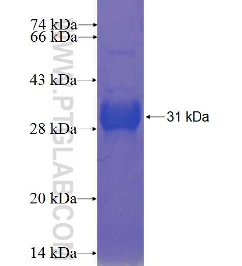 Cyclin D1 fusion protein Ag23241 SDS-PAGE