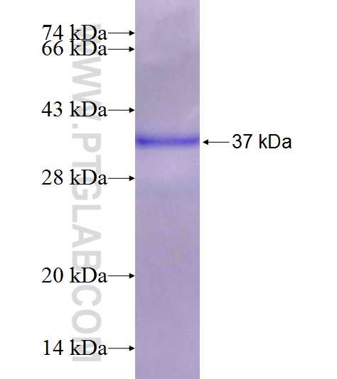 Cyclin D1 fusion protein Ag25384 SDS-PAGE