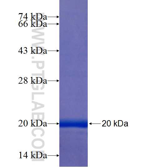 Cyclin D1 fusion protein Ag25393 SDS-PAGE