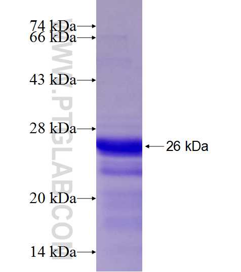 Cyclin D1 fusion protein Ag19109 SDS-PAGE