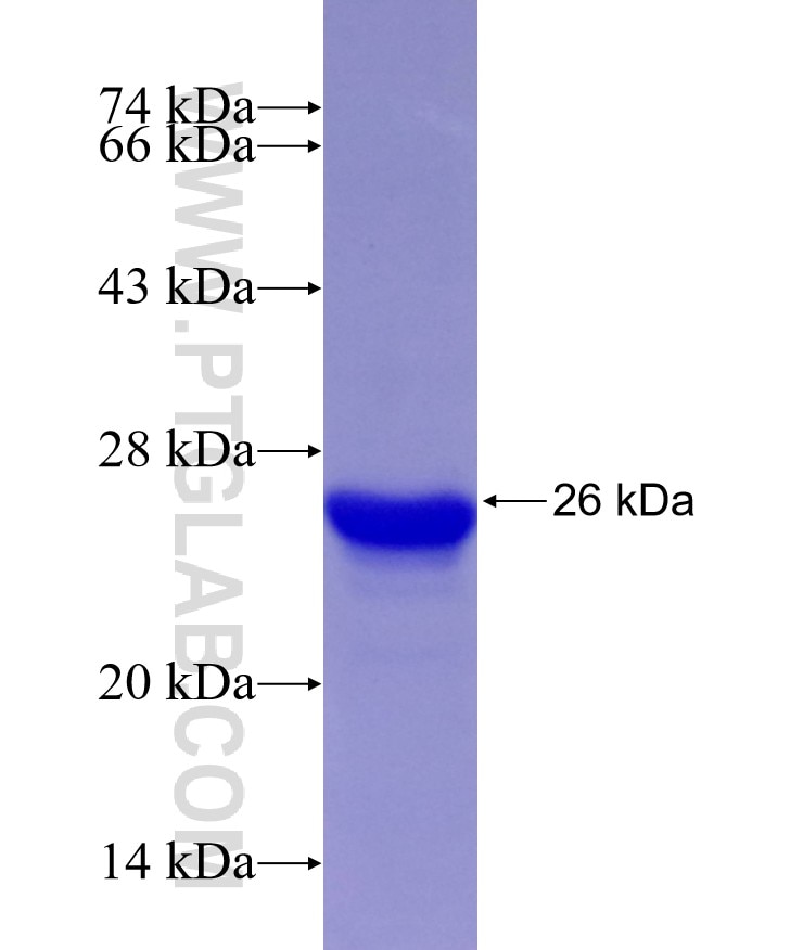 Cyclin D1 fusion protein Ag19109 SDS-PAGE