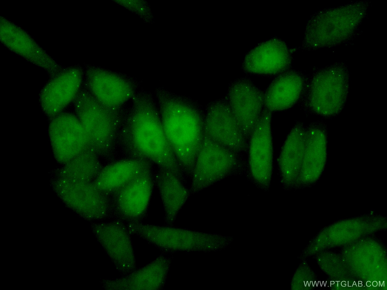 Immunofluorescence (IF) / fluorescent staining of HeLa cells using Cyclin D3 Polyclonal antibody (26755-1-AP)