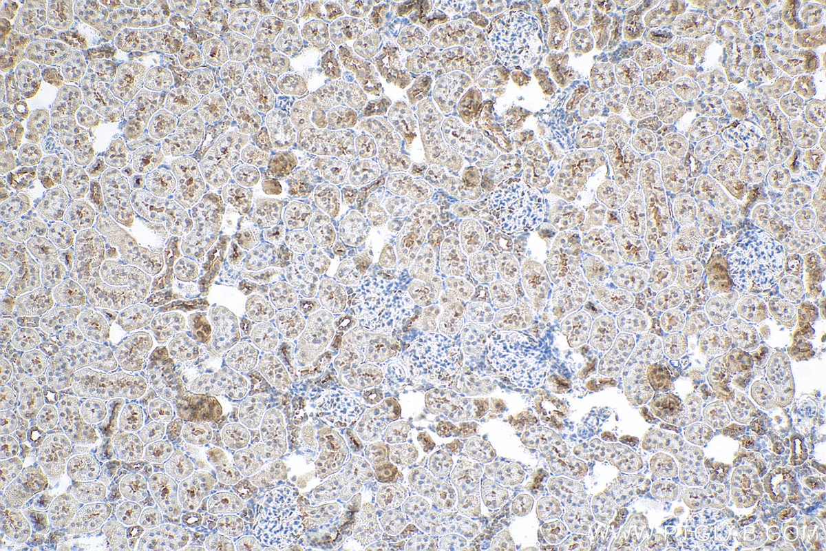 Immunohistochemistry (IHC) staining of rat kidney tissue using Cyclin D3 Polyclonal antibody (26755-1-AP)