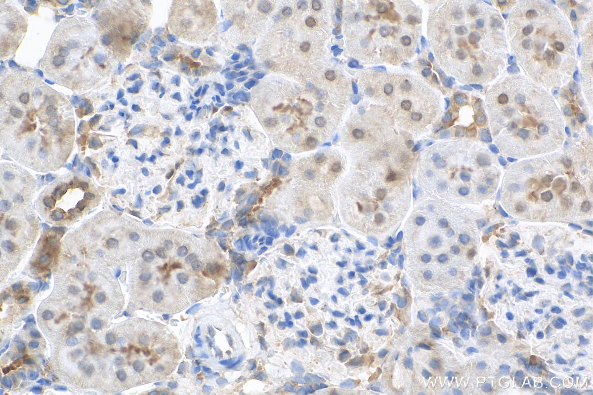 Immunohistochemistry (IHC) staining of rat kidney tissue using Cyclin D3 Polyclonal antibody (26755-1-AP)