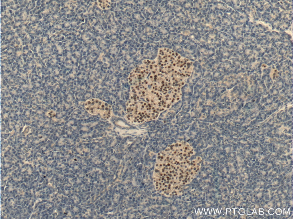 Immunohistochemistry (IHC) staining of human pancreas tissue using Cyclin D3 Polyclonal antibody (26755-1-AP)