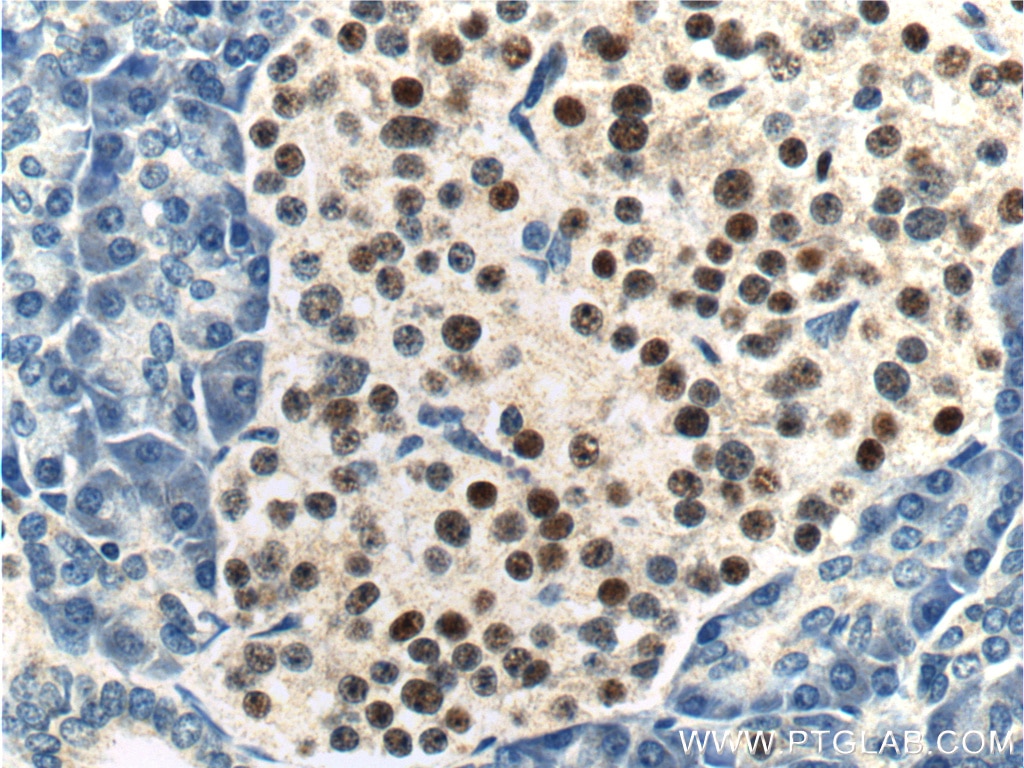 Immunohistochemistry (IHC) staining of human pancreas tissue using Cyclin D3 Polyclonal antibody (26755-1-AP)