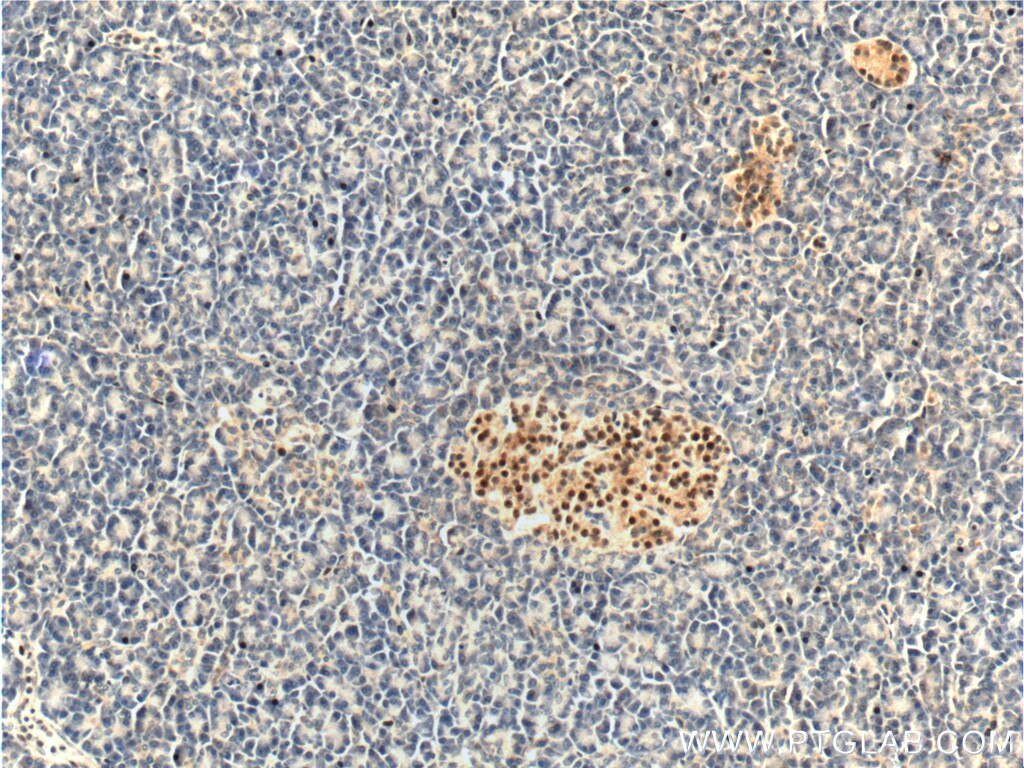 Immunohistochemistry (IHC) staining of human pancreas tissue using Cyclin D3 Polyclonal antibody (26755-1-AP)