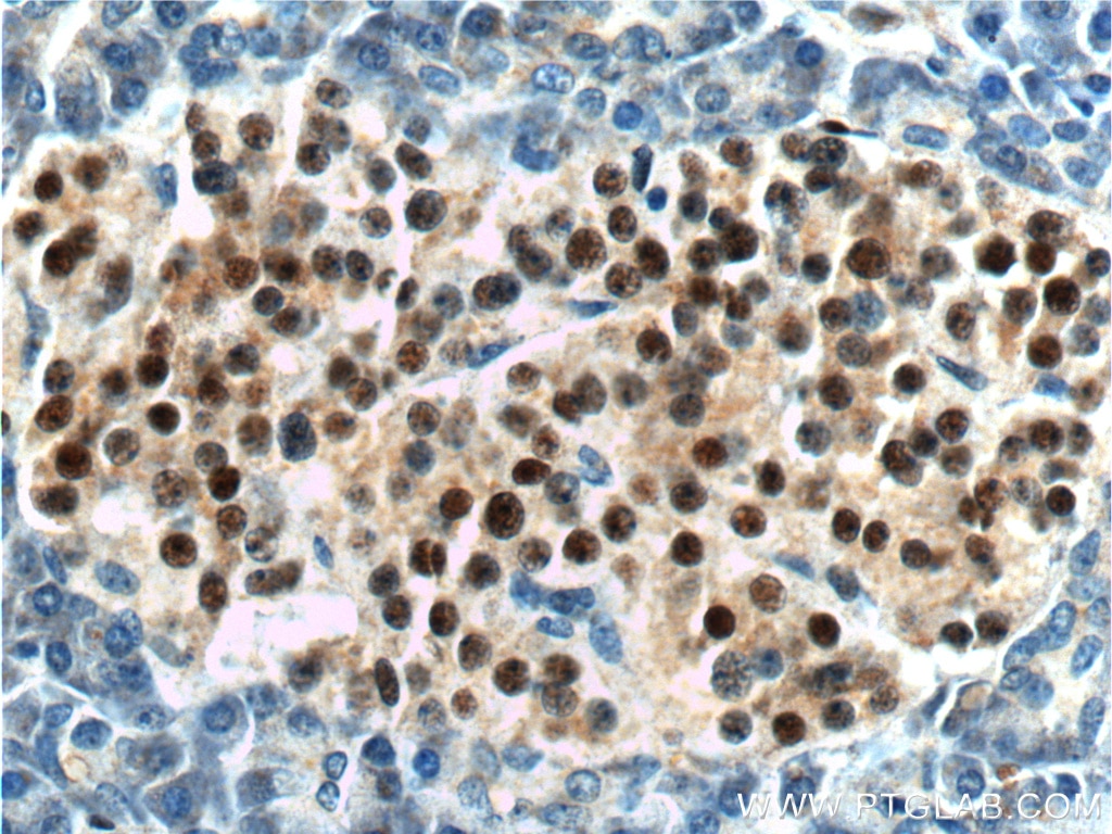 Immunohistochemistry (IHC) staining of human pancreas tissue using Cyclin D3 Polyclonal antibody (26755-1-AP)
