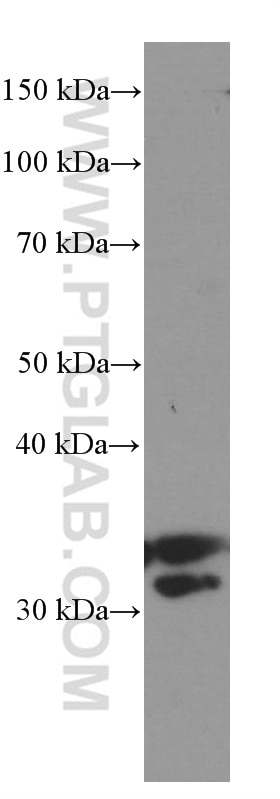 Western Blot (WB) analysis of Jurkat cells using Cyclin D3 Monoclonal antibody (66357-1-Ig)