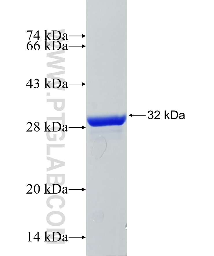 Cyclin D3 fusion protein Ag25151 SDS-PAGE