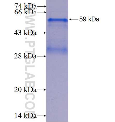 Cyclin D3 fusion protein Ag1292 SDS-PAGE