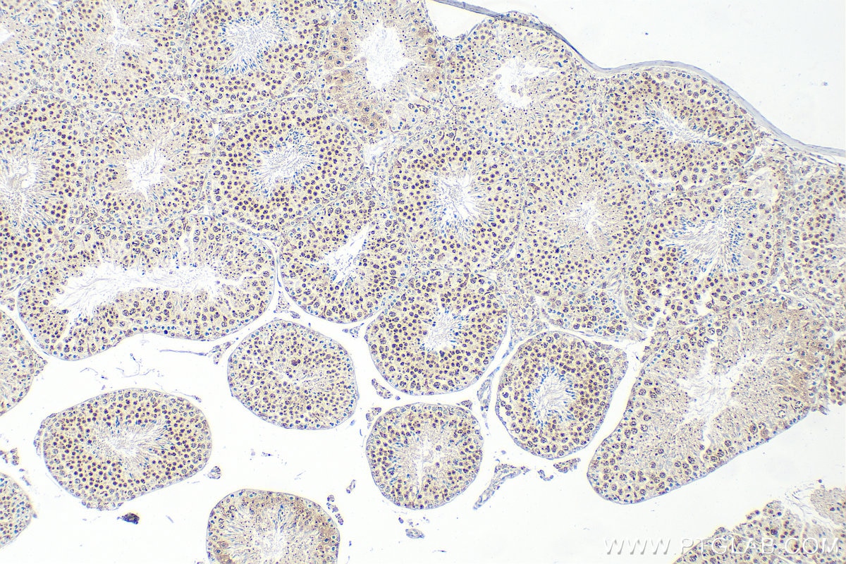 Immunohistochemistry (IHC) staining of mouse testis tissue using Cyclin E1 Recombinant antibody (82700-9-RR)