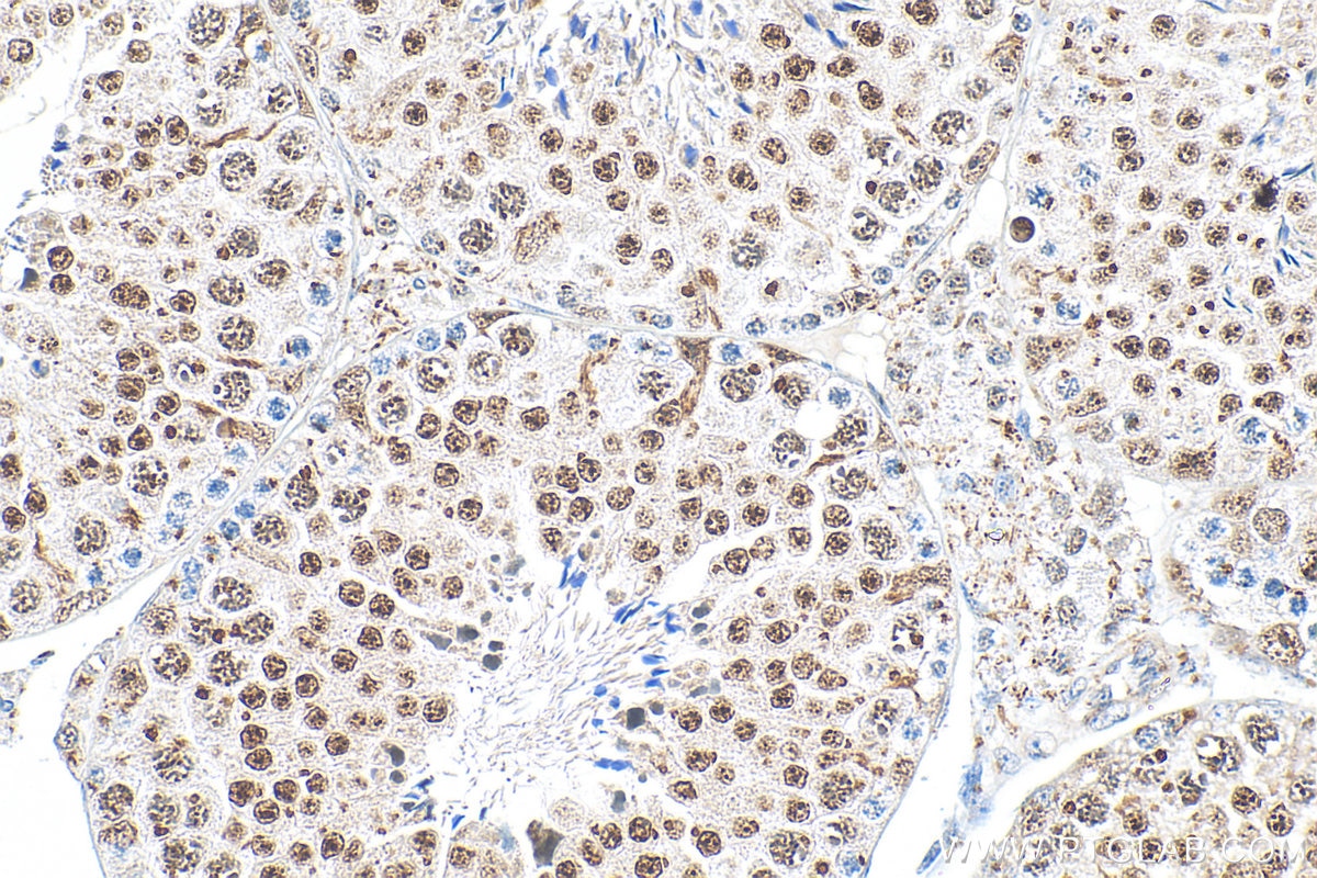 Immunohistochemistry (IHC) staining of mouse testis tissue using Cyclin E1 Recombinant antibody (82700-9-RR)