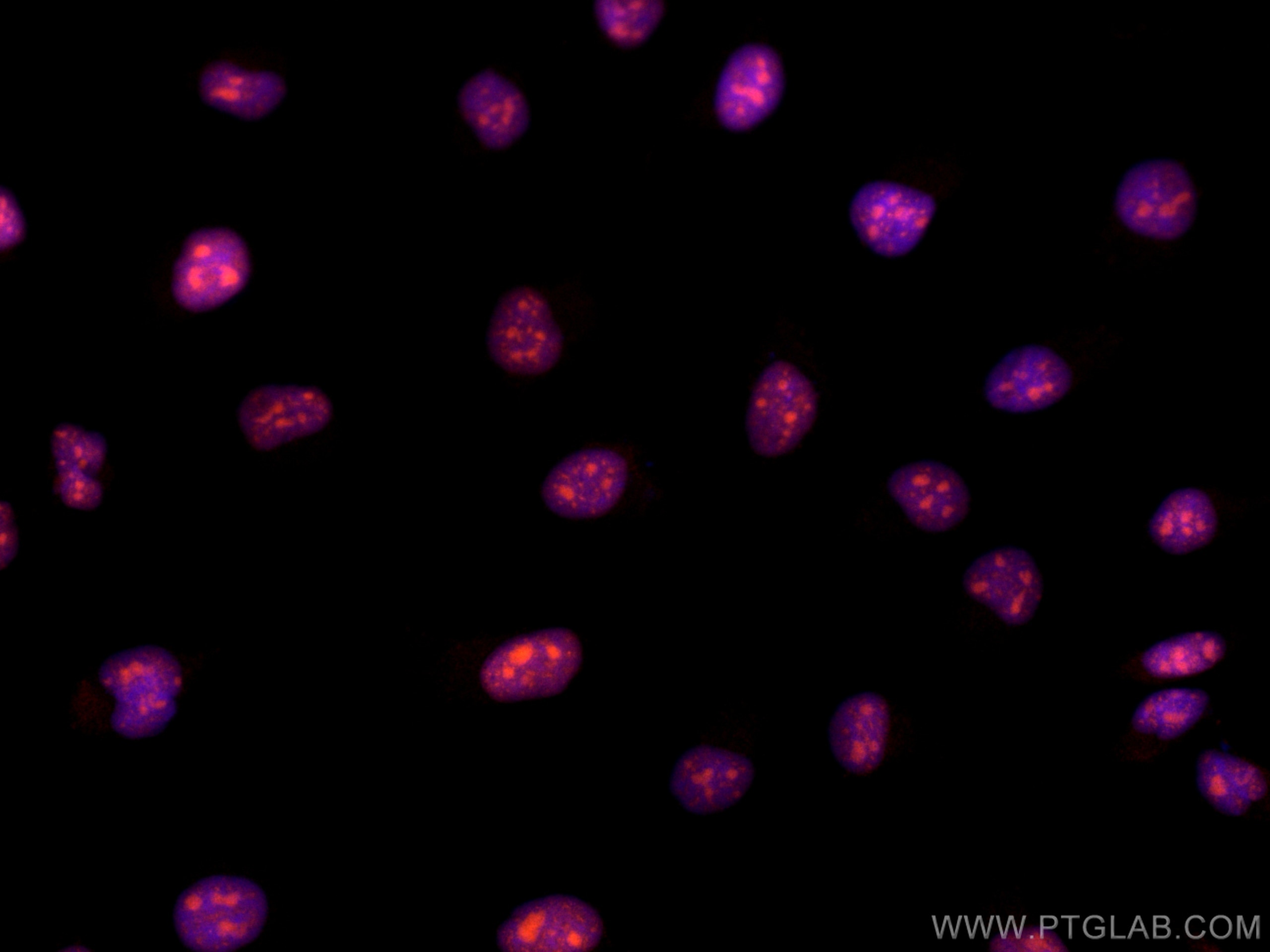 Immunofluorescence (IF) / fluorescent staining of HeLa cells using CoraLite®555-conjugated Cyclin E2 Polyclonal antib (CL555-11935)