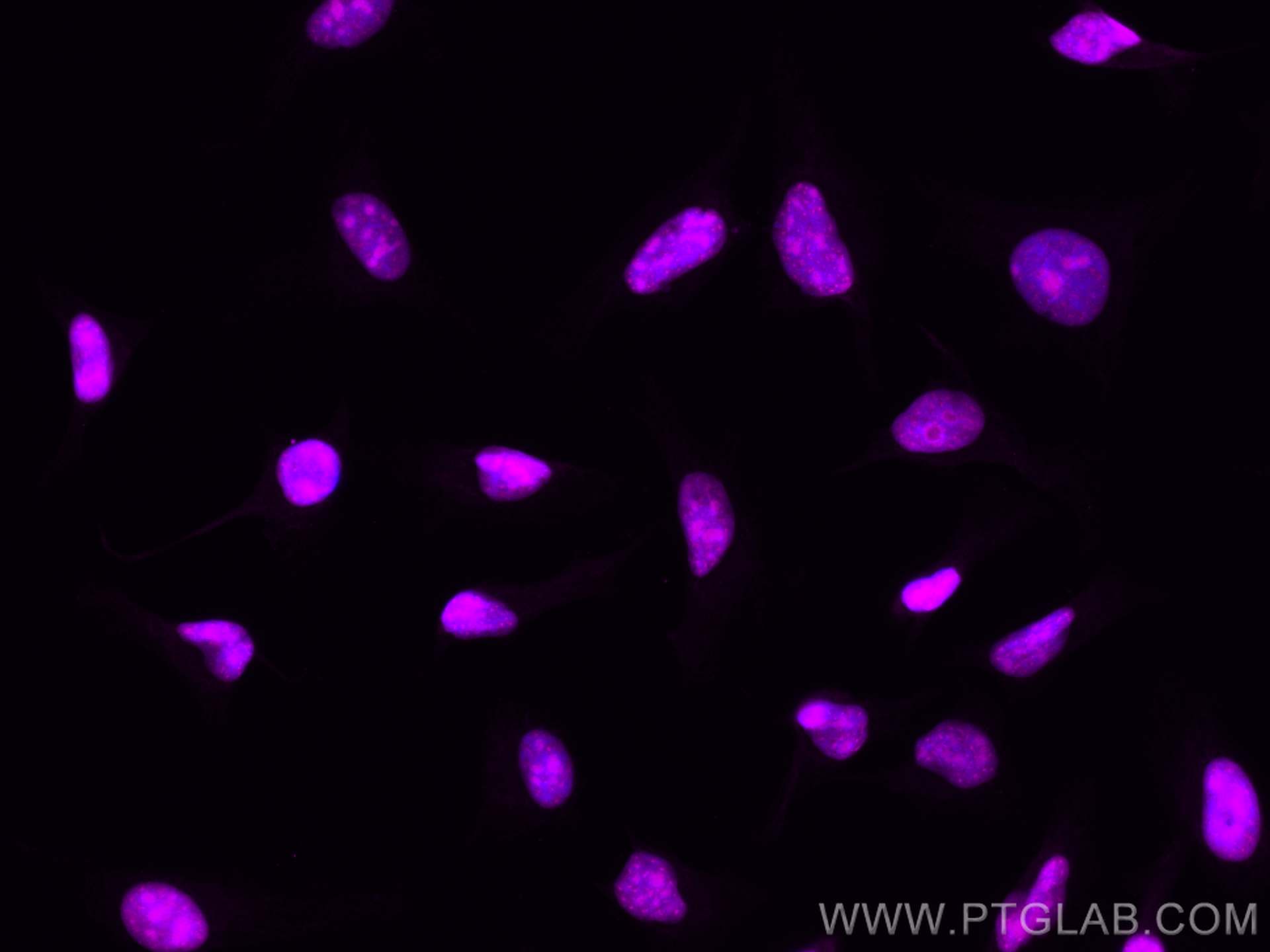Immunofluorescence (IF) / fluorescent staining of HeLa cells using CoraLite® Plus 647-conjugated Cyclin E2 Polyclonal (CL647-11935)