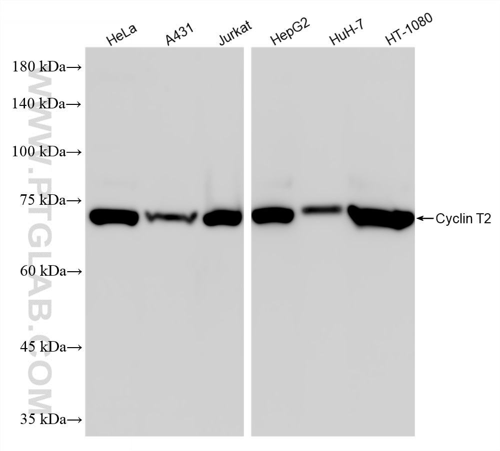 Western Blot (WB) analysis of various lysates using Cyclin T2 Recombinant monoclonal antibody (86859-3-RR)