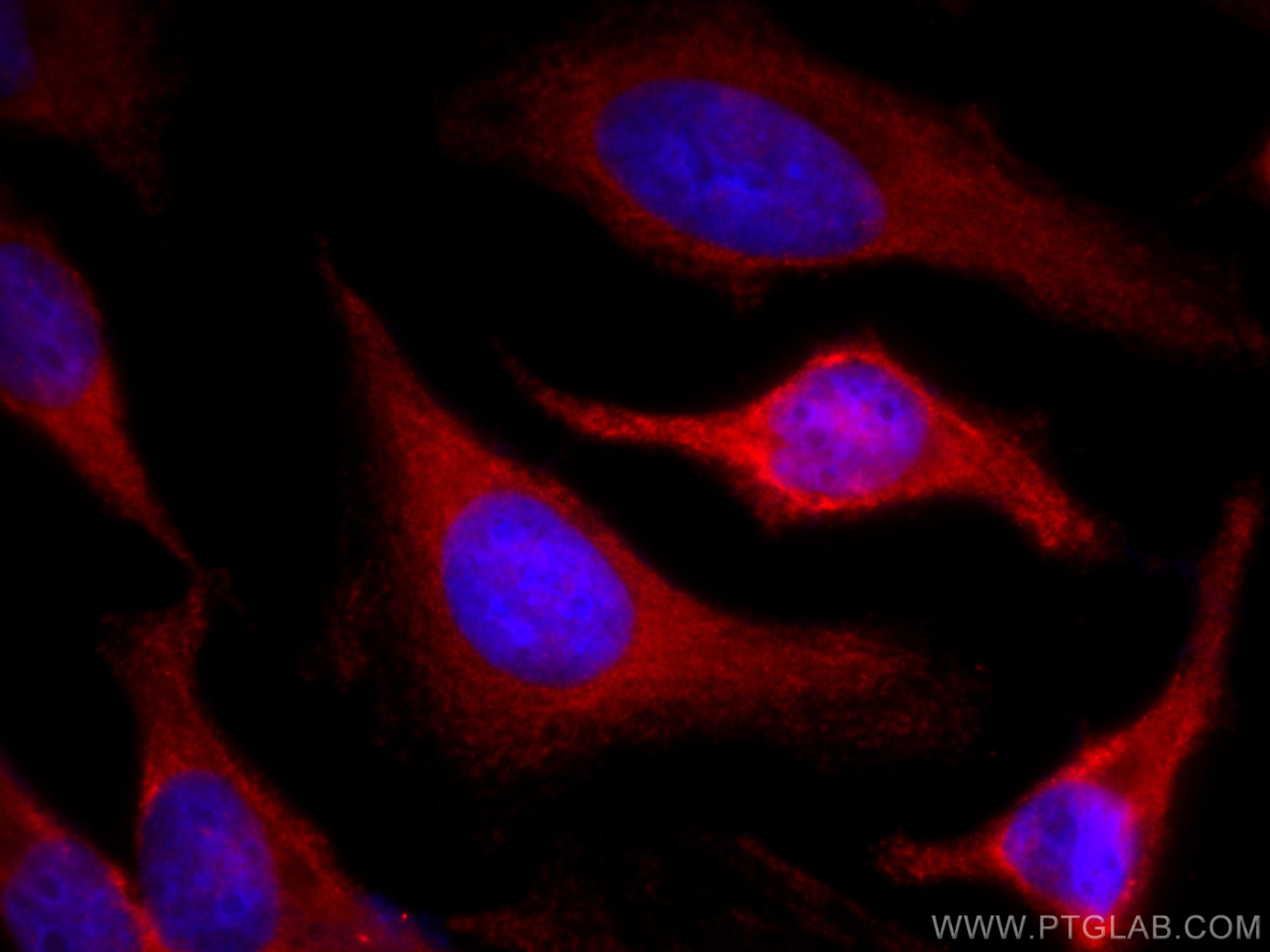 Immunofluorescence (IF) / fluorescent staining of HeLa cells using CoraLite®594-conjugated Cyclophilin A Monoclonal a (CL594-67880)